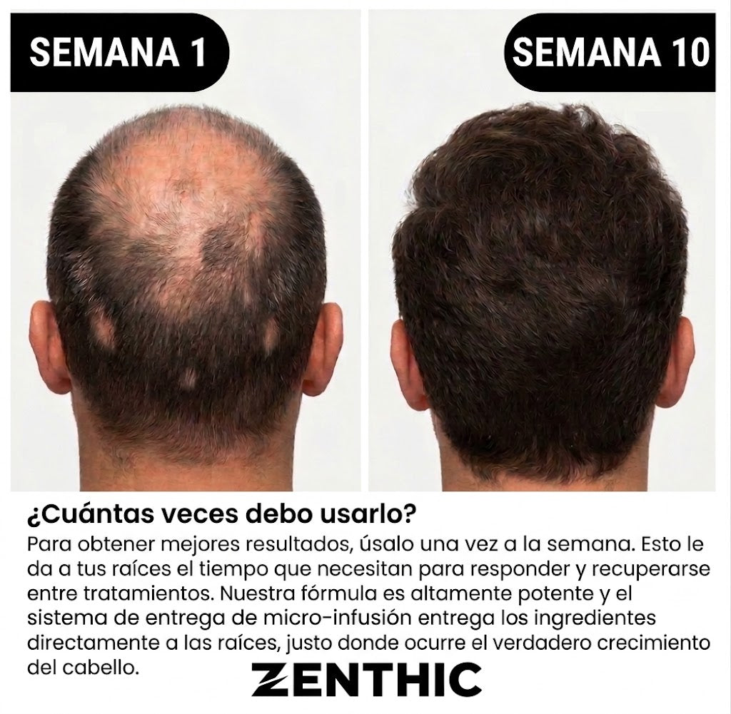 Zenthic – Growth Serum