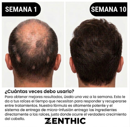 Zenthic – Growth Serum